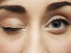 Eye twitching