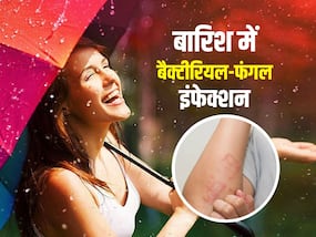 बारिश में बढ़ जाता है बैक्टीरियल और फंगल इंफेक्शन का खतरा, बचाव के लिए अपनाएं ये 5 टिप्स