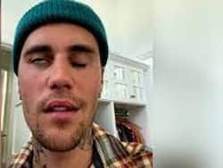 Ramsay Hunt Syndrome Gives Justin Bieber Facial Paralysis: All About This Viral Infection