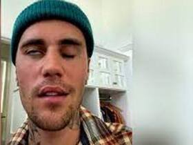 Ramsay Hunt Syndrome Gives Justin Bieber Facial Paralysis: All About This Viral Infection