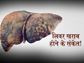 शरीर में दिख रहे ये 5 लक्षण लिवर से जुड़ी समस्या की ओर करते हैं इशारा