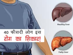 भारत में 40 फीसदी लोग लिवर की इस बीमारी के शिकार! साइंटिस्ट्स ने चेताया अगली महामारी की ओर बढ़ रहा देश