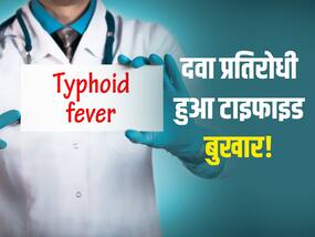 एंटीबायोटिक के ज्यादा इस्तेमाल से टाइफाइड बुखार हुआ दवा प्रतिरोधी! साल में 1 करोड़ से ज्यादा आते हैं मामले