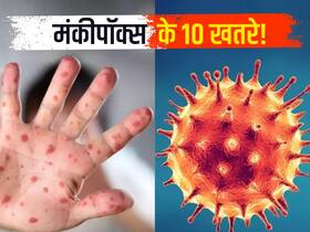 मंकीपॉक्स के मामलों की संख्या 1000 के पार, डब्लूएचओ के इन 10 प्वाइंट्स से जानें असली खतरा हुआ अब शुरू