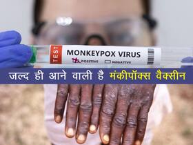 जल्द ही आने वाला है मंकीपॉक्स का टीका (Monkeypox vaccine): WHO