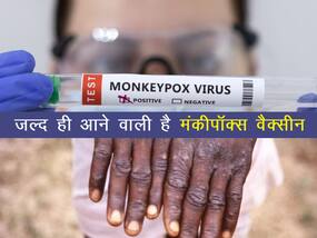 जल्द ही आने वाला है मंकीपॉक्स का टीका (Monkeypox vaccine): WHO