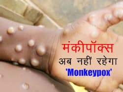 जल्द ही नए नाम से जाना जाएगा 'Monkeypox', दुनियाभर के एक्सपर्ट्स के साथ काम कर रहा है डब्लूएचओ