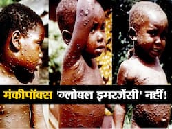 मंकीपॉक्स फिलहाल के लिए 'ग्लोबल इमरजेंसी' नहीं! समिति में मतभेदों के बाद WHO का फैसला