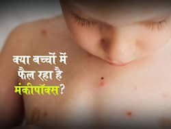 मंकीपॉक्स जैसे लक्षण दिखने पर जांच के लिए भेजा गया गाजियाबाद की एक बच्ची का सैंपल, बचाव के लिए जानें 4 अहम बातें