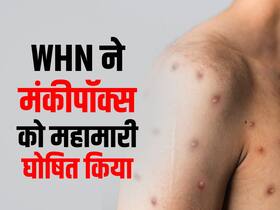 वर्ल्ड हेल्थ नेटवर्क (WHN) ने मंकीपॉक्स को महामारी घोषित किया, कहा-रोकथाम के लिए वैश्विक कार्रवाई की जरुरत