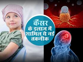यह नई तकनीक करेगी कैंसर का इलाज? जल्द ही होगा ह्यूमन ट्रायल शुरू, जानें इस तकनीक के बारे में कुछ खास बातें