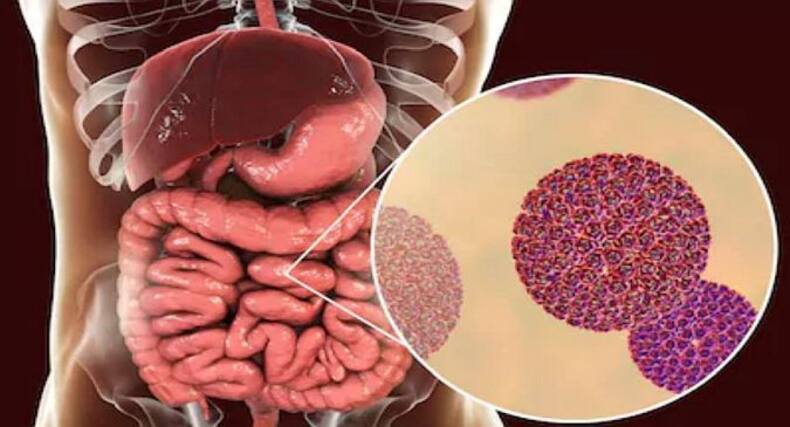 5 Potential Risks Of Severe Bowel Problems In Infants