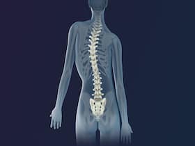 Juvenile Idiopathic Scoliosis: 12 Year Old Girl With S-Shaped Spine Given A New Lease Of Life