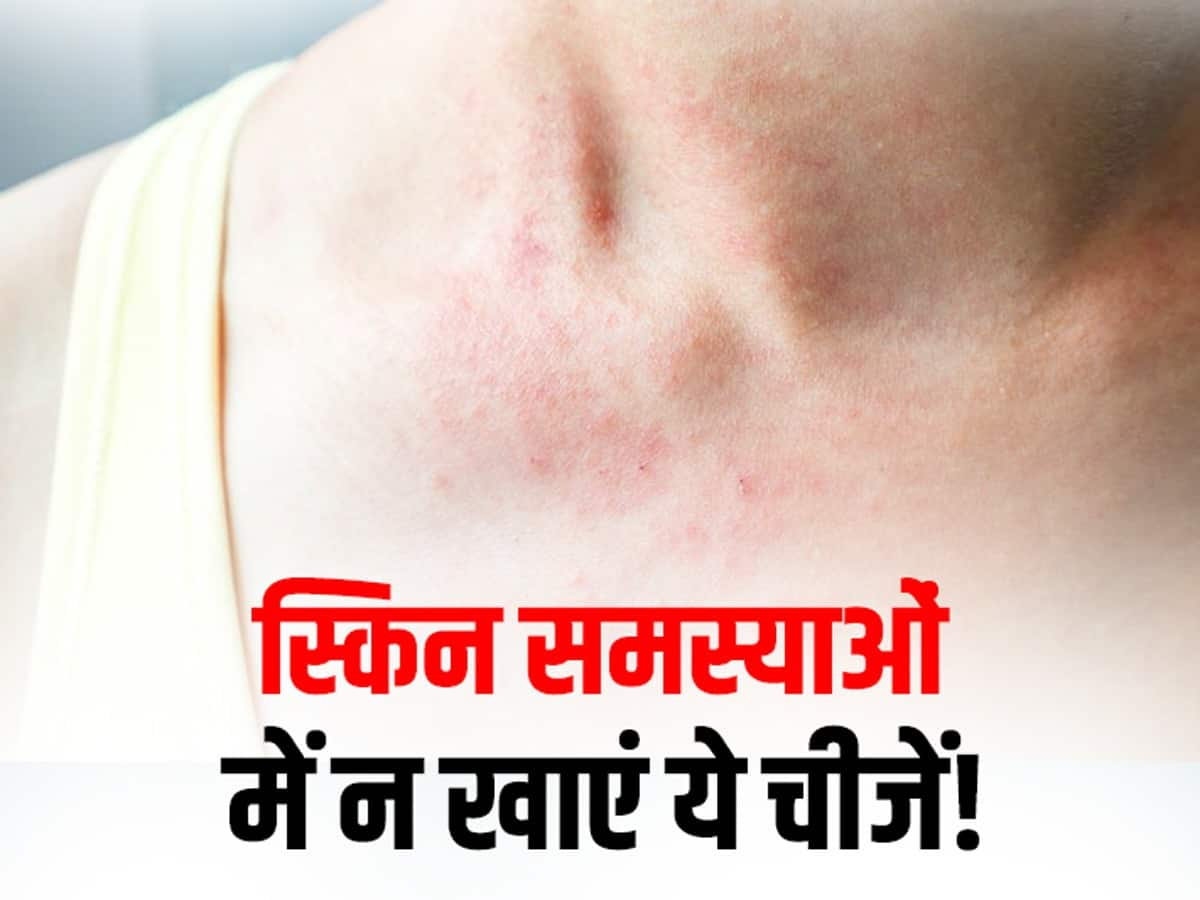 types of skin diseases in hindi