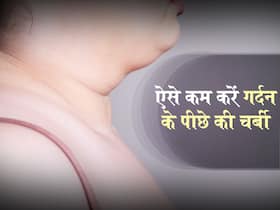 गर्दन के पीछे जमा चर्बी गर्मियों में बन सकती है दाद और खुजली का कारण, छुटकारा पाने के लिए करें ये 5 काम