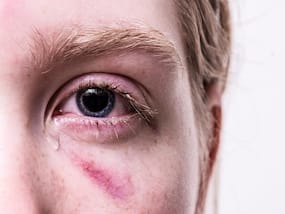 Detachment In Trauma Patients Can Be An Indicator Of Mental Health Problems