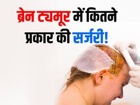 ब्रेन ट्यूमर के लिए सर्जरी कितनी जरूरी! जानें मरीजों के लिए ट्यूमर से बचने के आसान तरीके ब्रेन ट्यूमर के लिए सर्जरी कितनी जरूरी! जानें मरीजों के लिए ट्यूमर से बचने के आसान तरीके