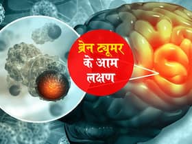 हल्का सिरदर्द और चलने में परेशानी भी हो सकता है ब्रेन ट्यूमर का लक्षण, जानें किन अंगों तक फैलता है ये ट्यूमर