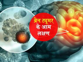 हल्का सिरदर्द और चलने में परेशानी भी हो सकता है ब्रेन ट्यूमर का लक्षण, जानें किन अंगों तक फैलता है ये ट्यूमर