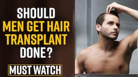 Hair Loss and Hair Transplant: Should Men Get Their Hair Transplant Done, Watch Video