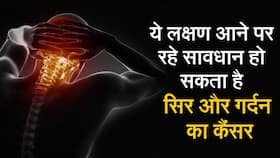 World Head Neck Cancer Day: सिर और गर्दन के कैंसर के शुरुआती लक्षण क्या हैं? जाने पूरी जानकारी, Watch Video