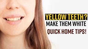 Teeth Whitening: Try These Home Remedies To Whiten Your Teeth, Watch Video