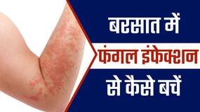 Fungal Infection: जाने फंगल इंफेक्शन के प्रकार, इसके कारण और इससे बचने के तरीके, Watch Video