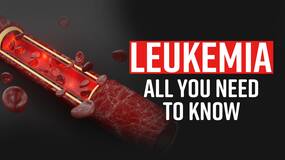 Leukemia: Know the Symptoms of Leukemia and its treatment, Watch Video