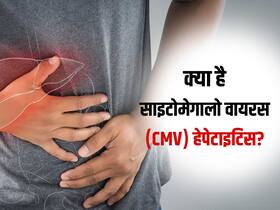 Cytomegalovirus Hepatitis: लिवर में सूजन और फेल्योर का कारण बन सकता है ये हेपेटाइटिस, जानें कारण और लक्षण
