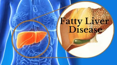 Non-Alcoholic Fatty Liver: ONE Symptom That Only Appears In the Morning ...