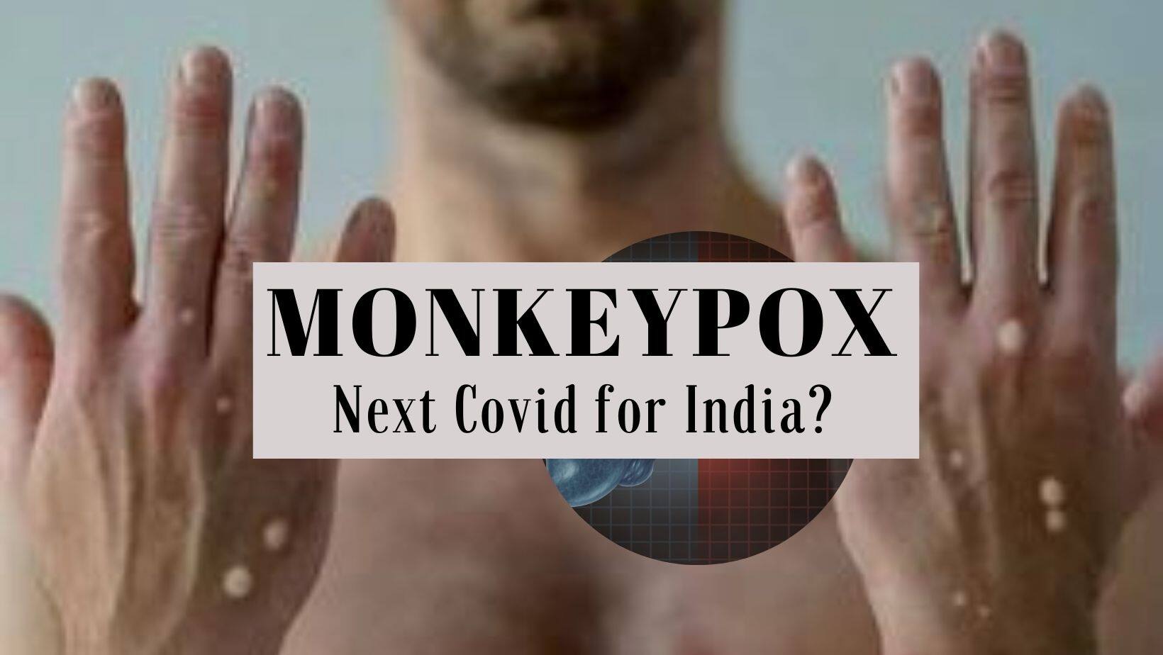 Explained: How fast does monkeypox spread and should India worry?