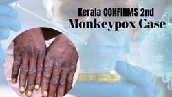 Monkeypox Spreading In India? Kerala Reports India's Second Monkeypox Case