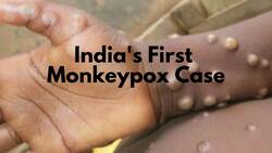 Monkeypox Enters India: First Case Confirmed In Kerala