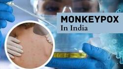 Monkeypox In India: Kerala Issues SOPs, Makes PCR Test, N-95 Masks Mandatory - CHECK Details Here
