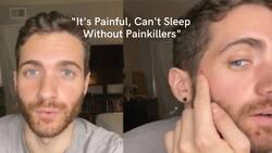 American Actor Matt Ford Comes Out In Public With Monkeypox Infection, Shares Symptoms He Is Facing
