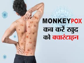 नोएडा में मिले मंकीपॉक्स के संदिग्ध में दिखे ये 2 लक्षण, जानें मंकीपॉक्स के कौन-से लक्षण दिखते ही हो जाना चाहिए आइसोलेट