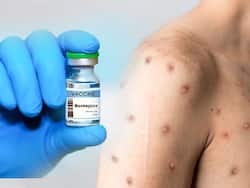 मंकीपॉक्स की वैक्सीन कब तक होगी भारत में उपलब्ध!, सीरम CEO अदार पूनावाला इस तरह जुटे तैयारी में