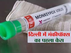 दिल्ली में आया मंकीपॉक्स का पहला मामला, मौलाना आजाद मेडिकल कॉलेज में भर्ती है व्यक्ति