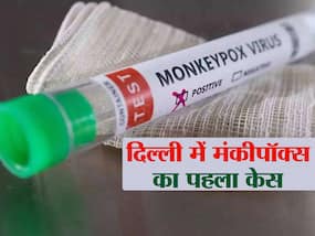 दिल्ली में आया मंकीपॉक्स का पहला मामला, मौलाना आजाद मेडिकल कॉलेज में भर्ती है व्यक्ति