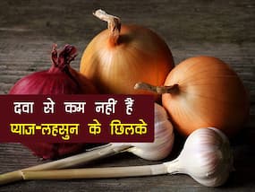 प्याज-लहसुन के छिलके नहीं है किसी दवा से कम, इन हेल्थ प्रॉब्लम्स से दिला सकते हैं आराम