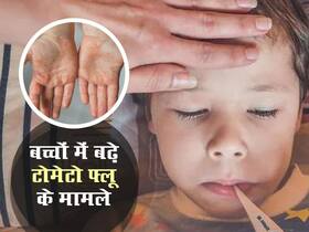केरल और तेलंगाना में बढ़े टोमेटो फ्लू के मामले, 5 साल के दो बच्चों में दिखे गंभीर लक्षण