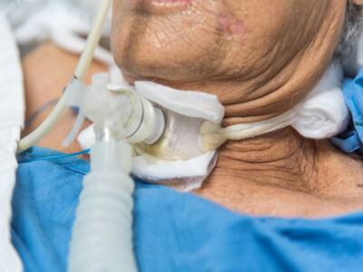 Tracheostomy: All About This Surgical Procedure That Creates A Hole In ...