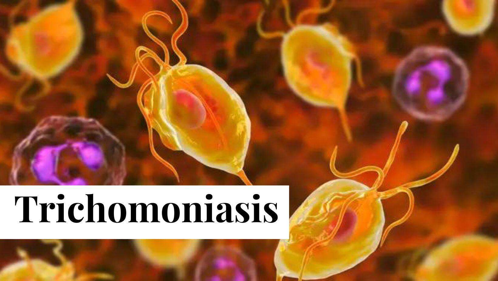 5 Unusual And Scary Diseases You Can Catch From Unprotected Intercourse