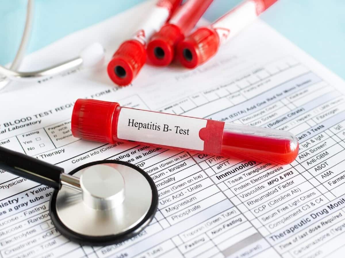 Hepatitis Can Cause Infertility In Men: Precautions You Can Take