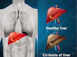 Stem Cell Therapy For Autoimmune Hepatitis: How It Works