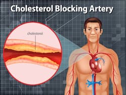 Hyperlipidemia: Ayurvedic Herbs That May Help Lower Your Cholesterol Levels