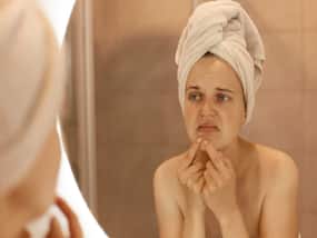 Adult Acne: Why Are You Still Breaking Out In Your 30s, 40s, And Even 50s?