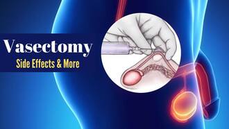 Vasectomy: Understanding the Procedure, Recovery, and Long-Term Effects -  Holy City Sinner