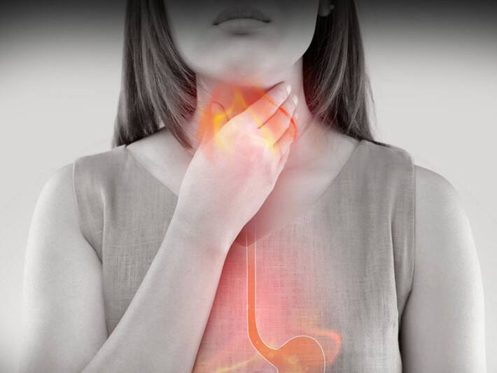 GERD 5 Common Myths About Gastroesophageal Reflux Disease Busted