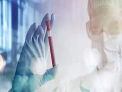 When To Do A Biopsy For The Prostate? Shares Dr Niti Krishna Raizada